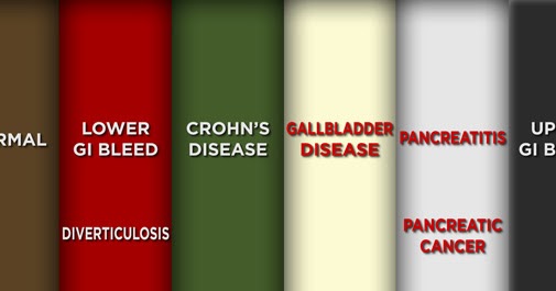 Red Wine And Green Poop: Causes And Concerns