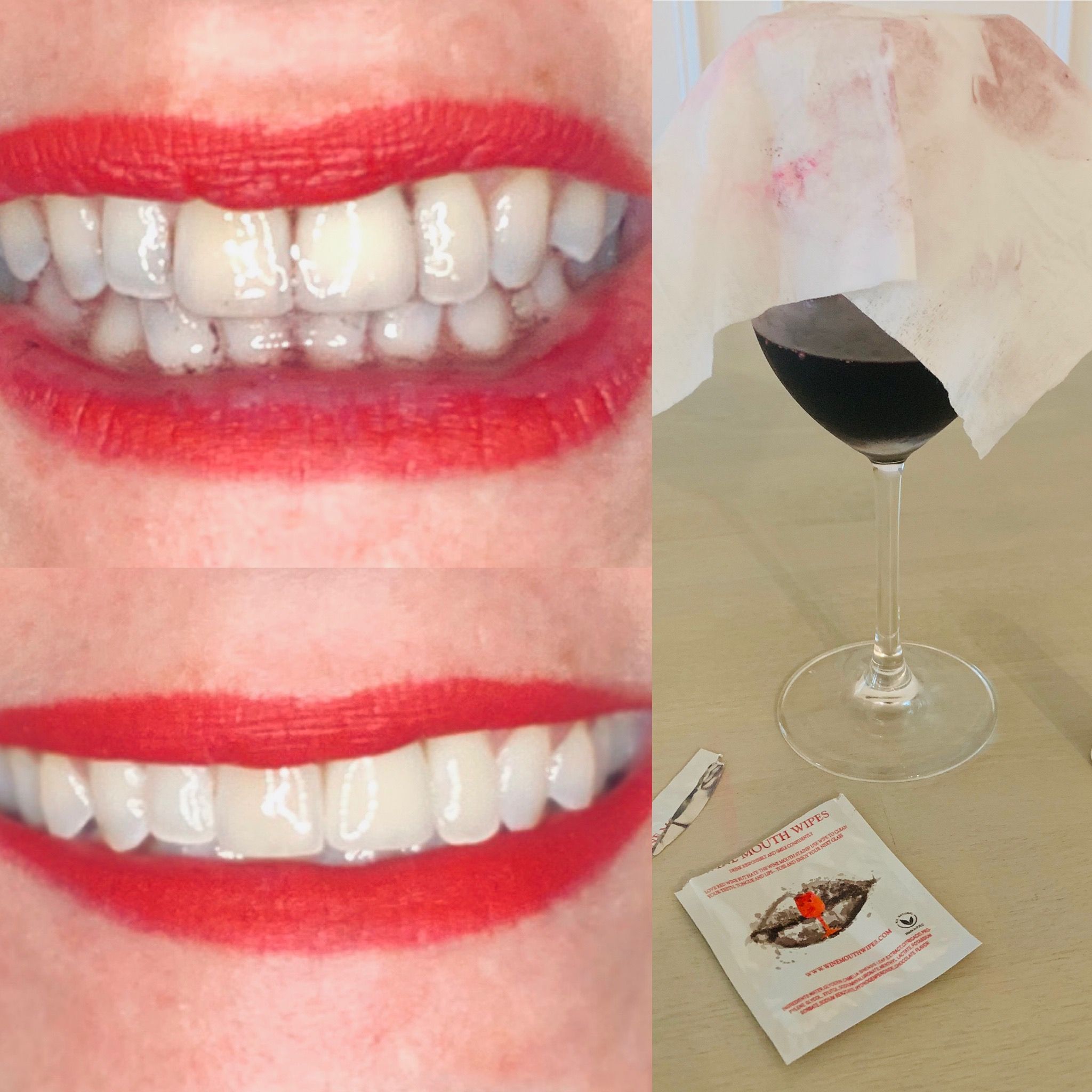 How Long After Whitening Teeth Can I Drink Red Wine?